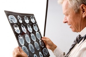 Bay Area Traumatic Brain Injury Victim